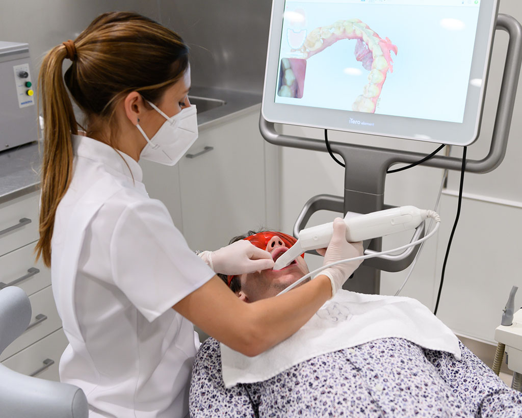 1. Escaneamos con el escáner intraoral iTero 3D Element y obtenemos una reproducción 3D de máxima calidad y precisión de tus dientes sobre los que confeccionaremos los alineadores SMILELINE.